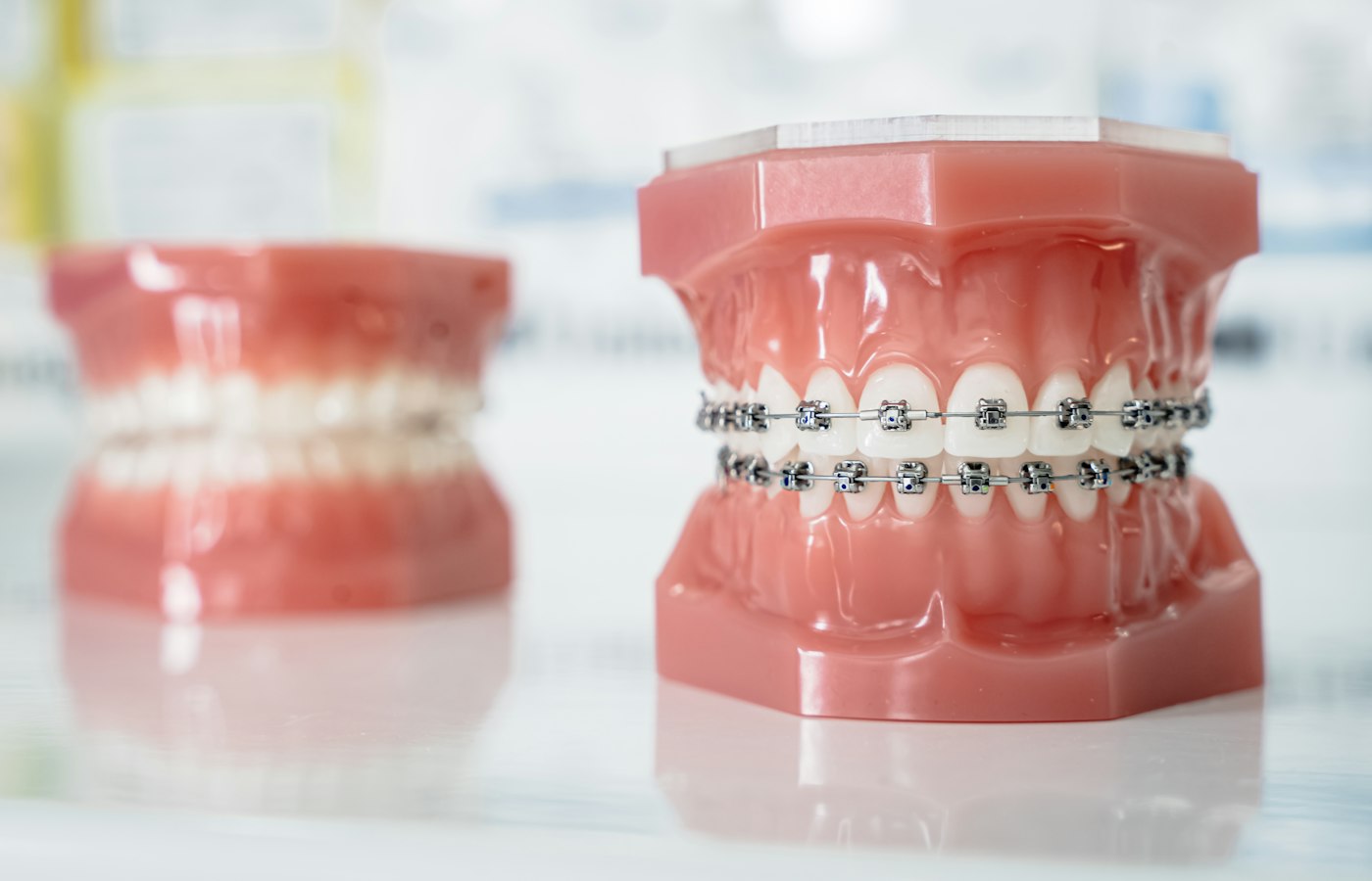 Model of teeth with braces