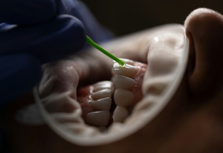 Dentist working on a tooth model