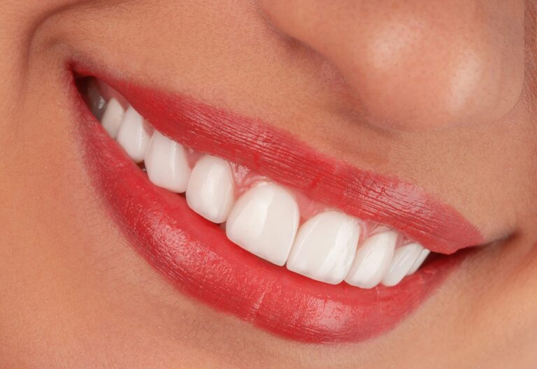 Bright, healthy smile
