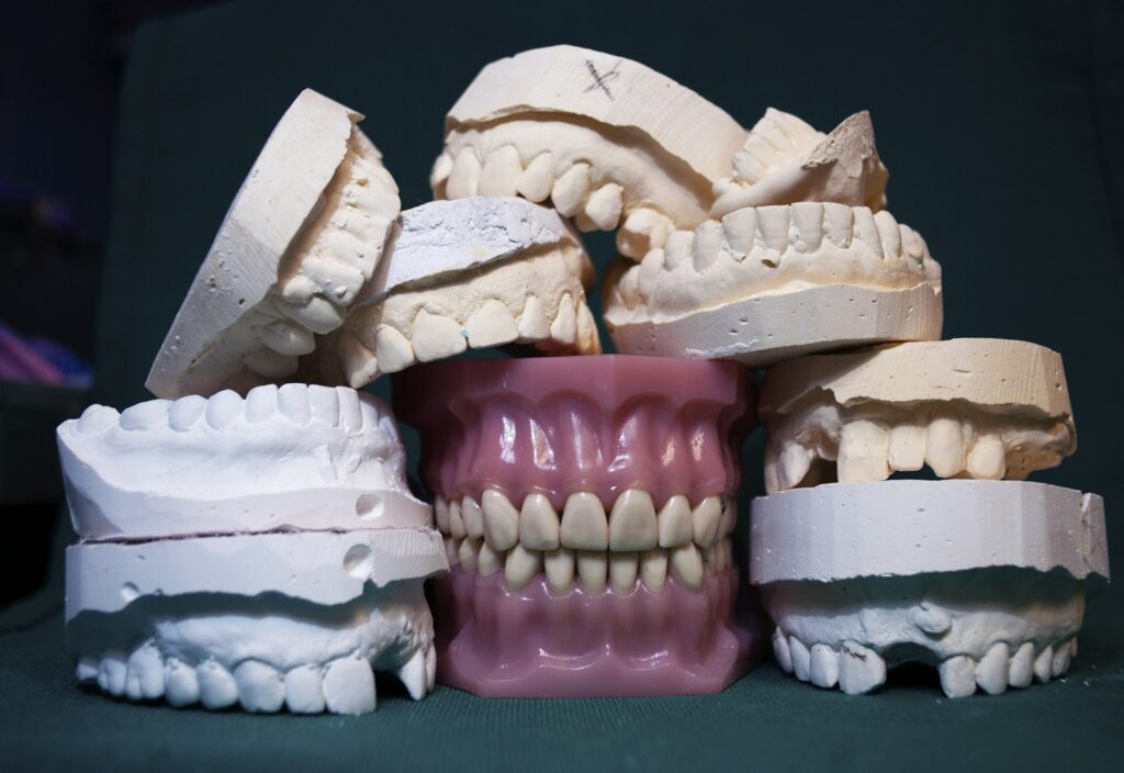 Dental models used to plan treatment