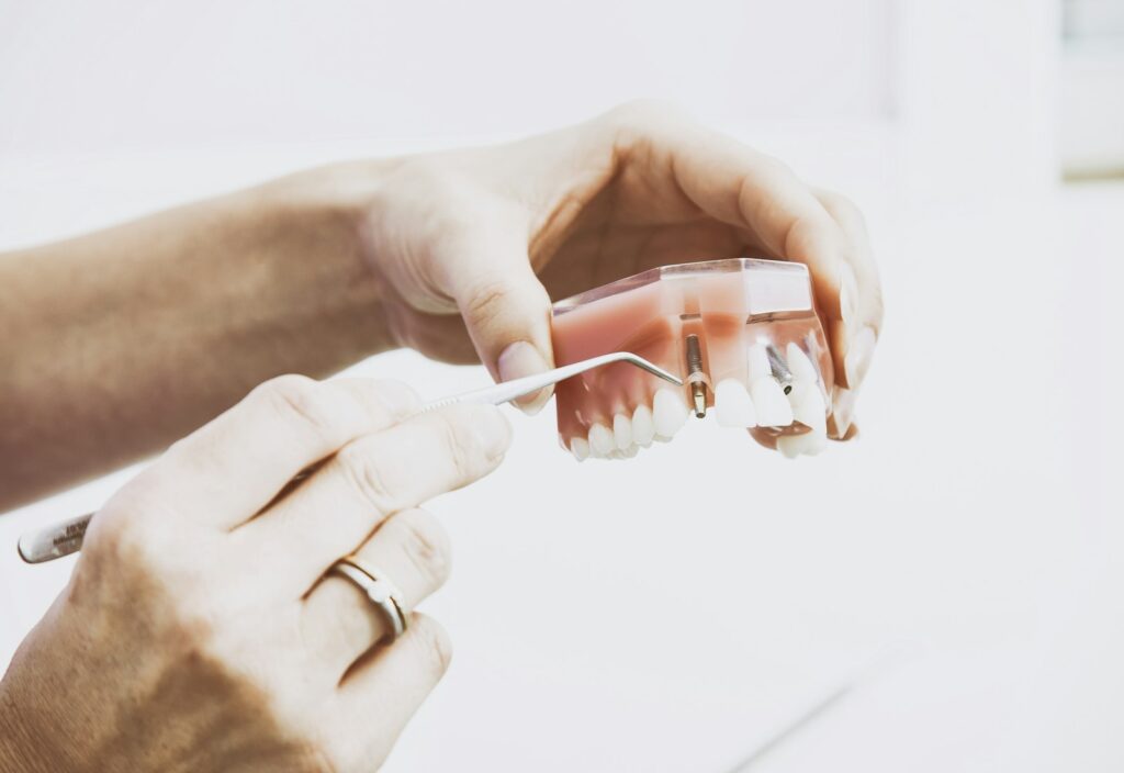 Dentist holding a dental implant model
