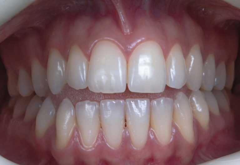 Healthy pink gums and teeth