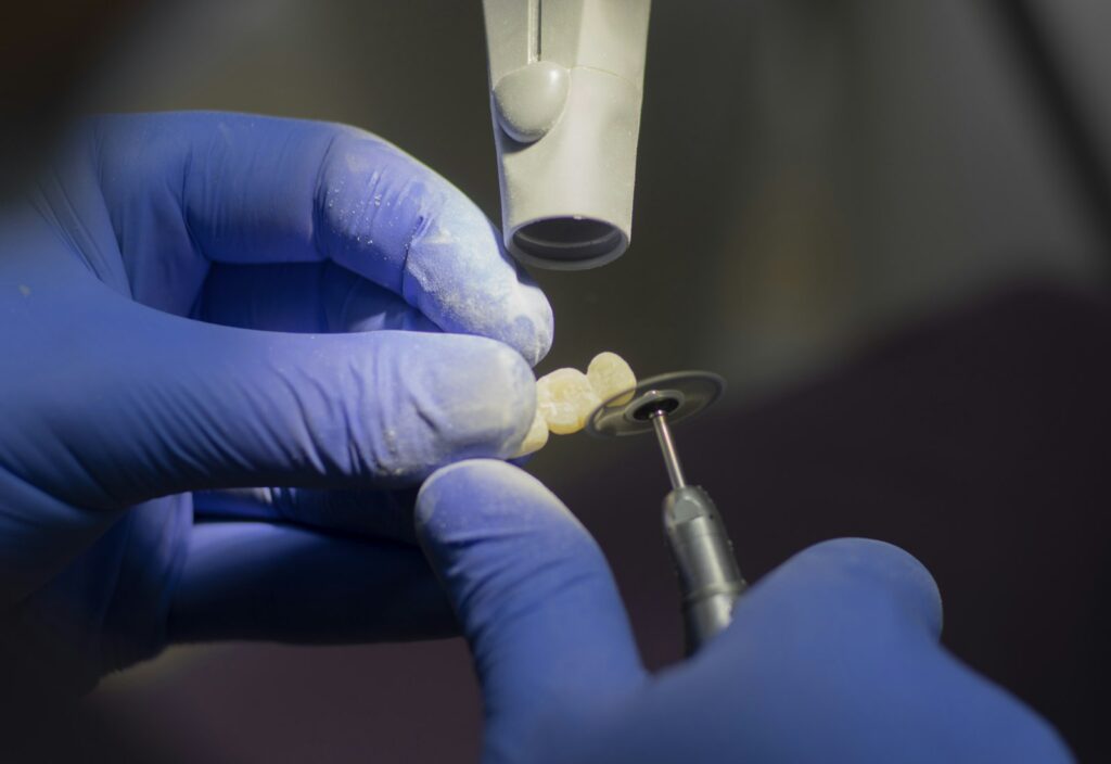 Dentist shaping a tooth restoration