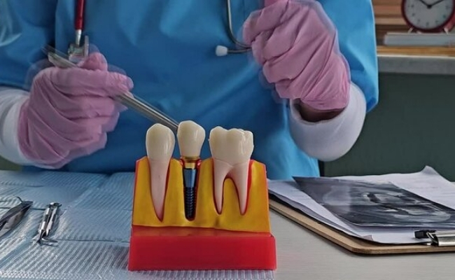 Root-Canals-30.jpg